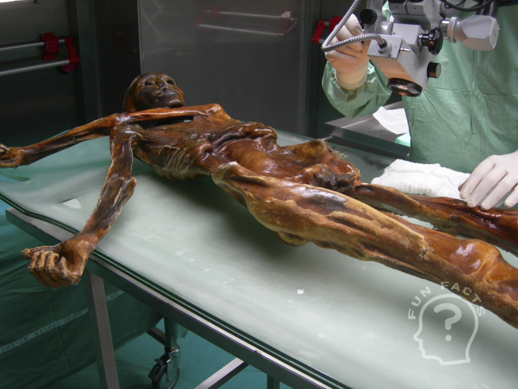 Ötzi's